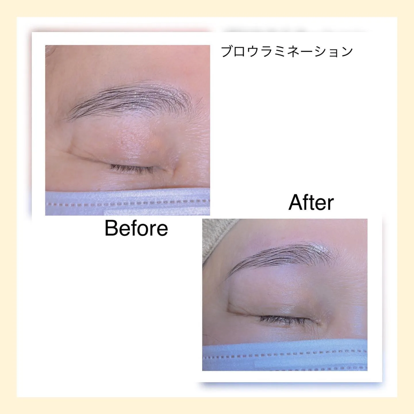 ブロウラミネーション