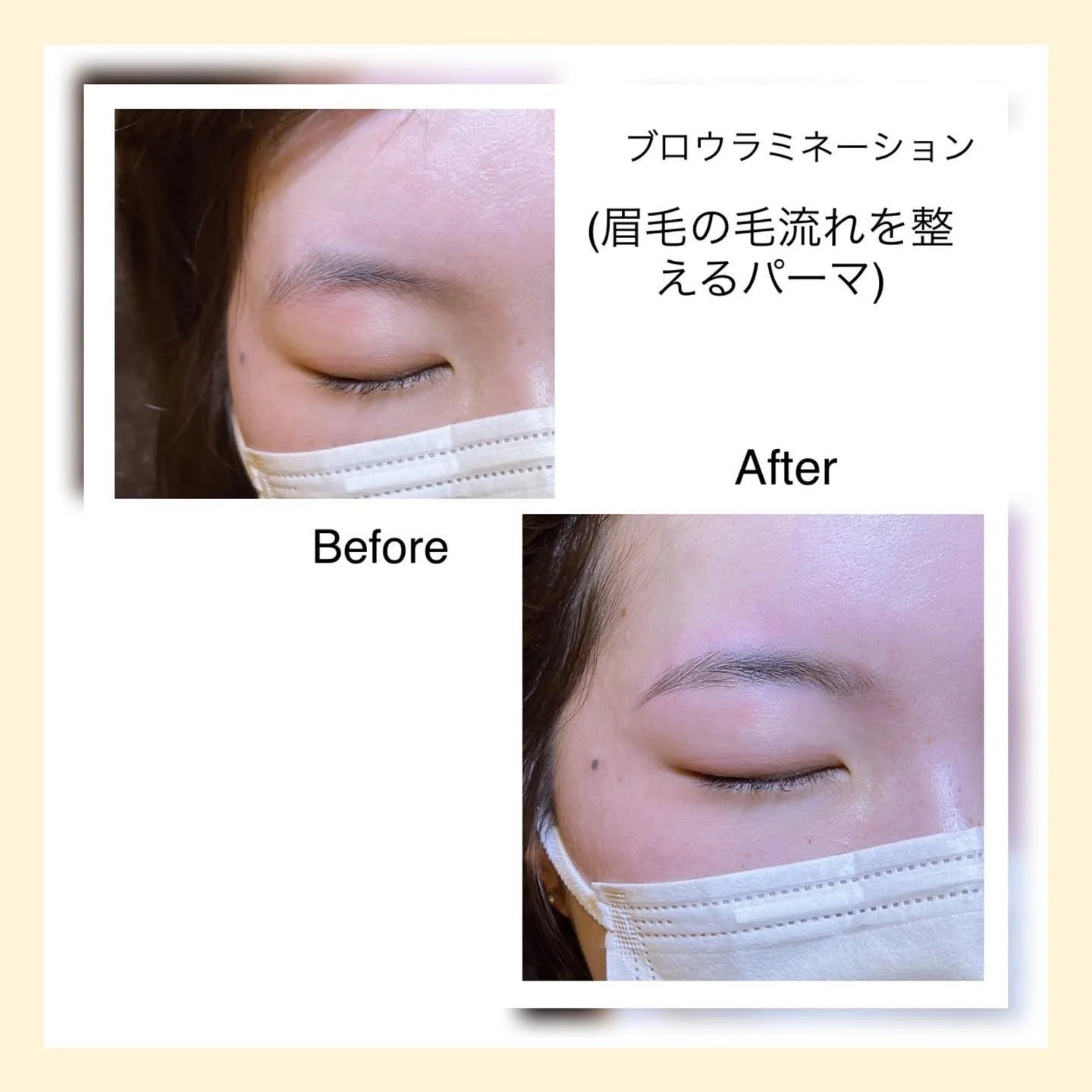 ブロウラミネーション