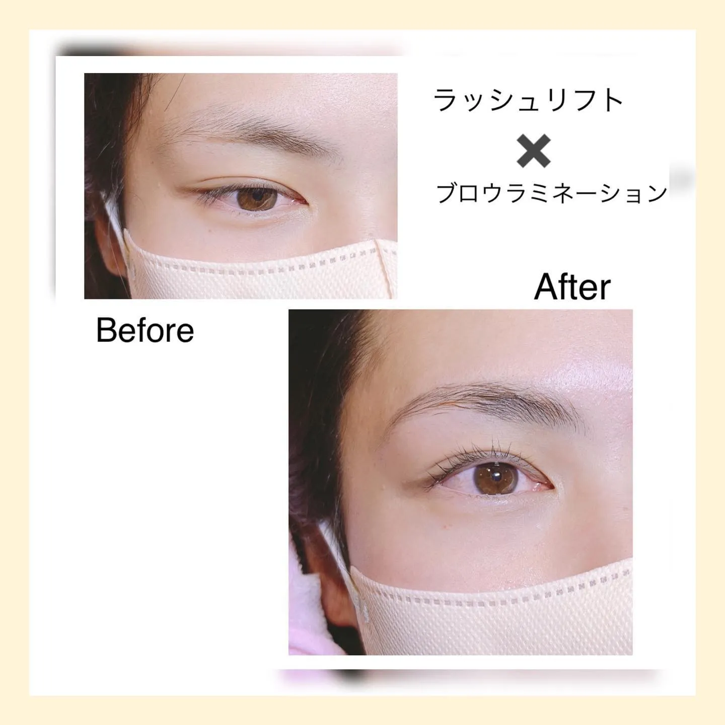 ラッシュリフト