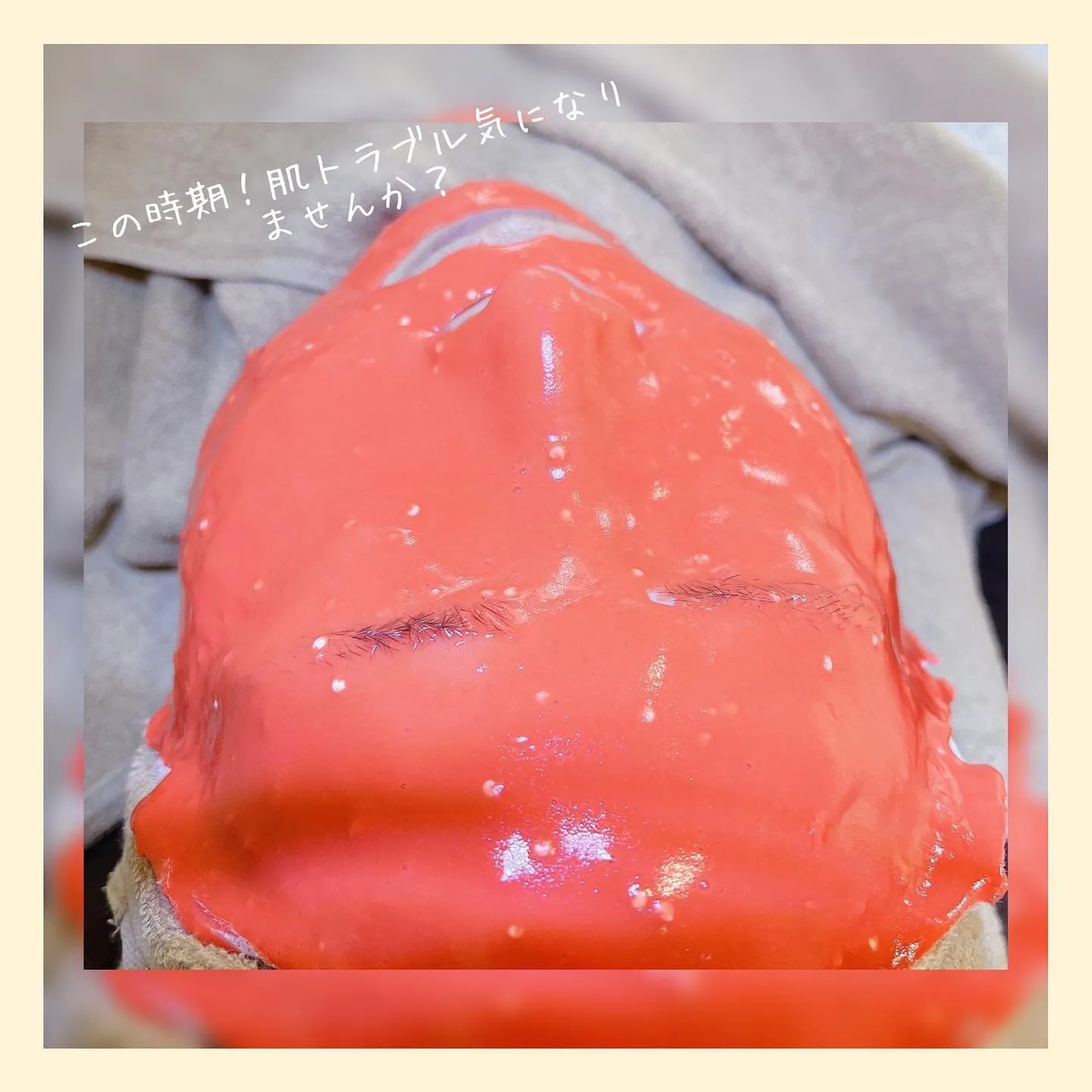 カスマラパック