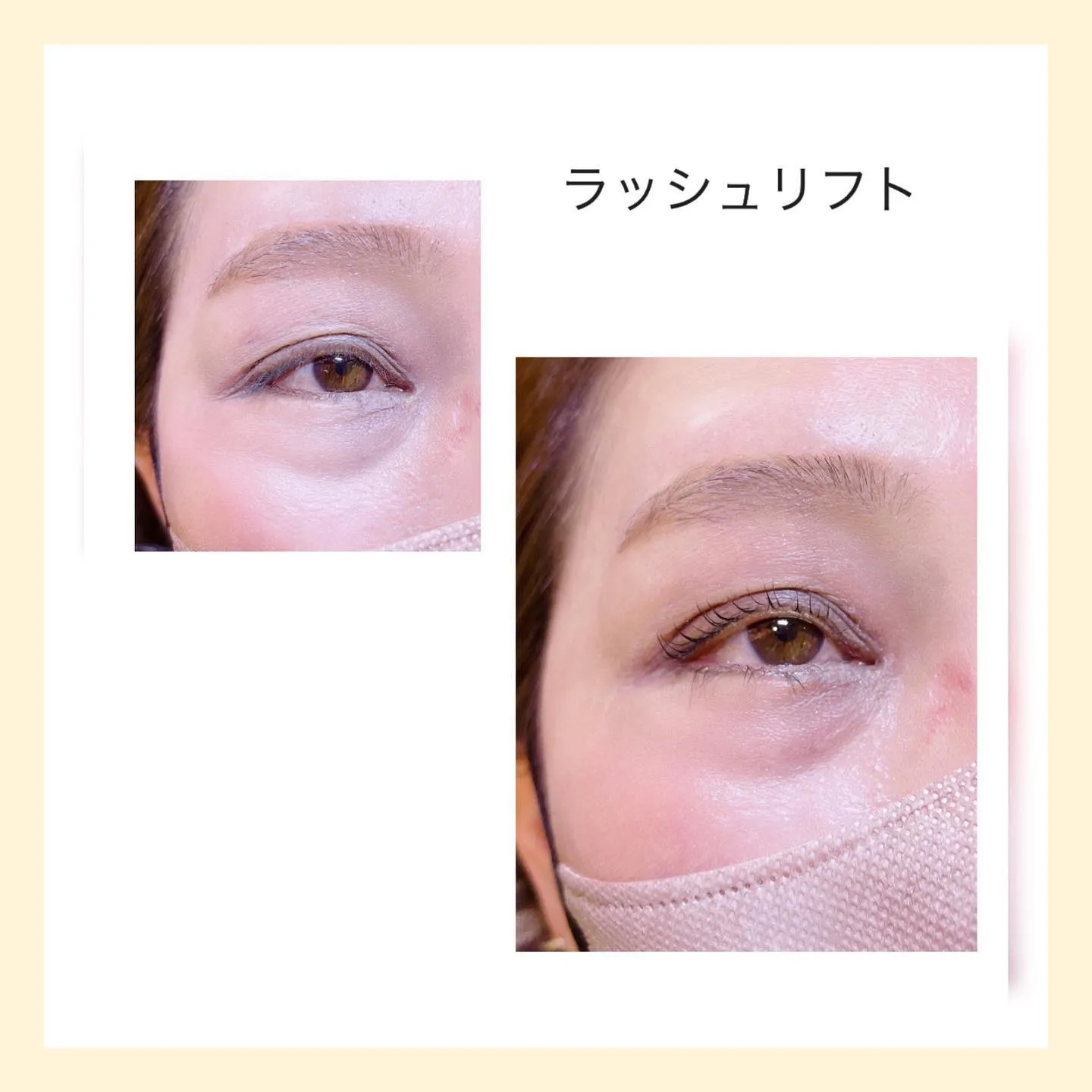 ラッシュリフト