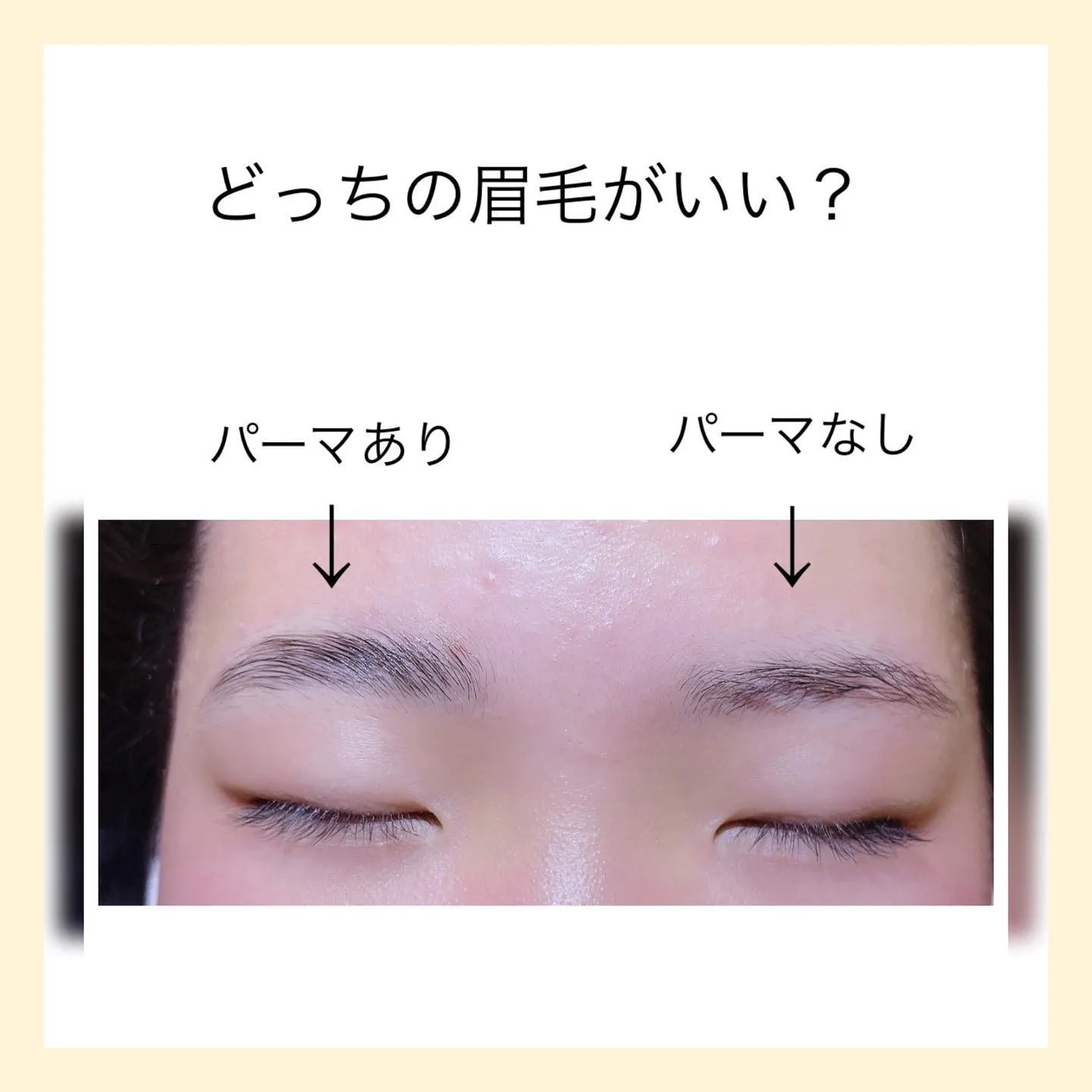 ブロウラミネーション