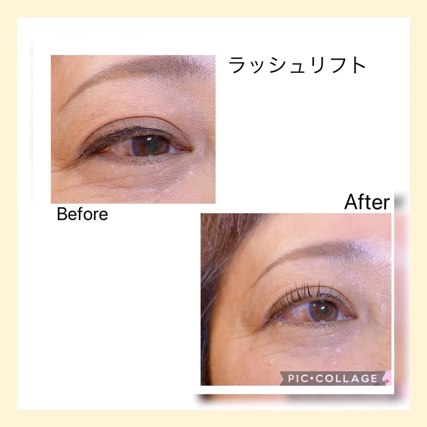 ラッシュリフト